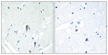 IRAK-M rabbit pAb Antibody