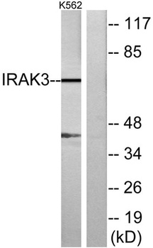 IRAK-M rabbit pAb Antibody