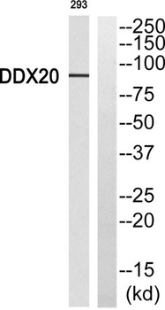 Gemin3 rabbit pAb Antibody