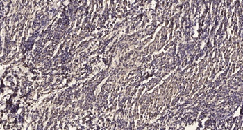 MKP-5 rabbit pAb Antibody