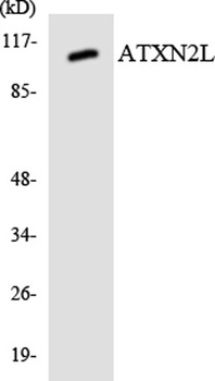 Ataxin-2L rabbit pAb Antibody