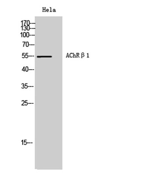 AChRβ1 rabbit pAb Antibody