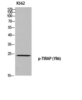 TIRAP (phospho Tyr86) rabbit pAb Antibody