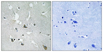 TIRAP (phospho Tyr86) rabbit pAb Antibody