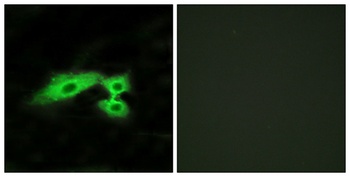 Mas1-like rabbit pAb Antibody