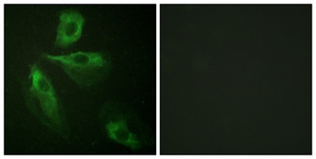 ADD1 rabbit pAb Antibody