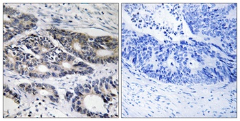 CYP2R1 rabbit pAb Antibody
