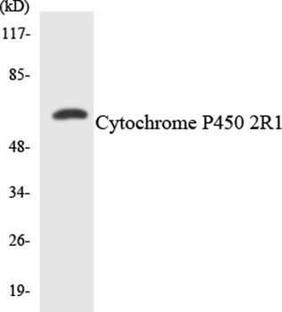 CYP2R1 rabbit pAb Antibody