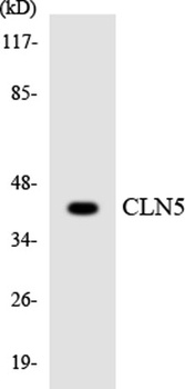 CLN5 rabbit pAb Antibody