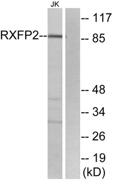 Relaxin Receptor 2 rabbit pAb Antibody
