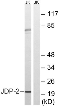 JDP2 rabbit pAb Antibody