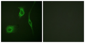 HSP20 (phospho Ser16) rabbit pAb Antibody