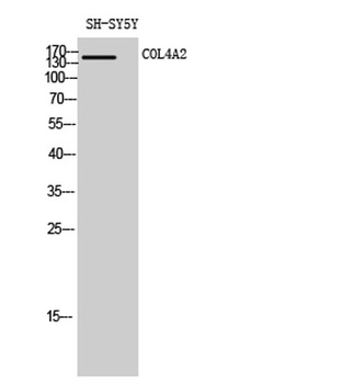 COL4A2 rabbit pAb Antibody