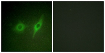 COL4A2 rabbit pAb Antibody