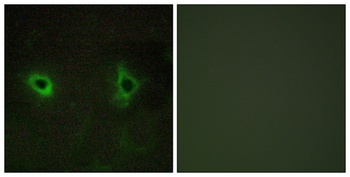 COL4A3 rabbit pAb Antibody