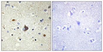 COL4A3 rabbit pAb Antibody