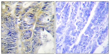 COL4A5 rabbit pAb Antibody