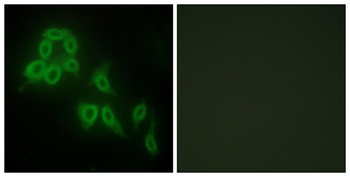 COL5A2 rabbit pAb Antibody
