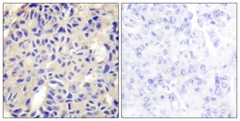 COL5A2 rabbit pAb Antibody