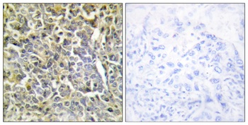 COL6A2 rabbit pAb Antibody