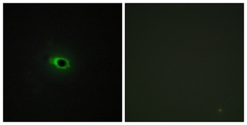 COL12A1 rabbit pAb Antibody