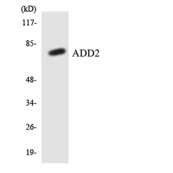COL12A1 rabbit pAb Antibody