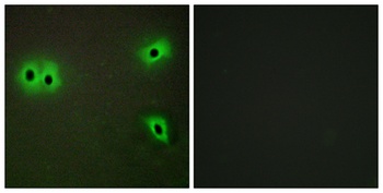 COL13A1 rabbit pAb Antibody