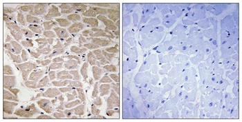 COL16A1 rabbit pAb Antibody