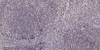 COL17A1 rabbit pAb Antibody