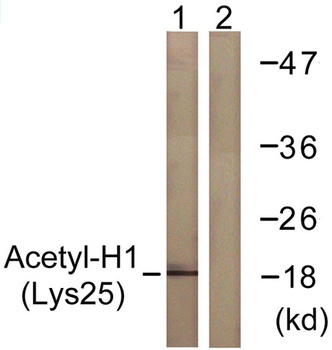 Acetyl Histone H1 (K25) rabbit pAb Antibody
