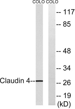 Claudin-4 rabbit pAb Antibody