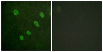 ATF-2 (phospho Ser480) rabbit pAb Antibody