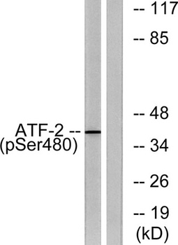 ATF-2 (phospho Ser480) rabbit pAb Antibody