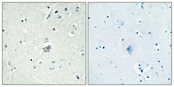 CRF-RII rabbit pAb Antibody