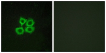 CRF-RII rabbit pAb Antibody