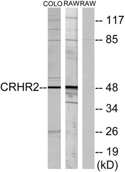 CRF-RII rabbit pAb Antibody