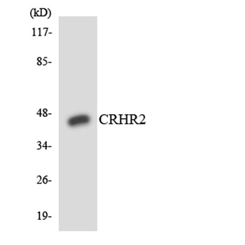 CRF-RII rabbit pAb Antibody