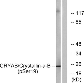 Crystallin-αB (phospho Ser19) rabbit pAb