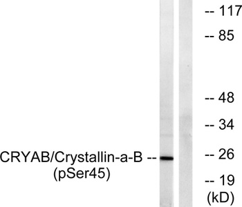 Crystallin-αB (phospho Ser45) rabbit pAb