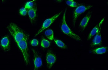 p38 rabbit pAb Antibody