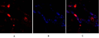 p38 rabbit pAb Antibody