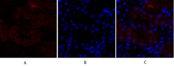 p38 rabbit pAb Antibody