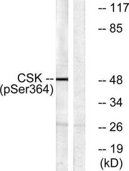 Csk (phospho Ser364) rabbit pAb Antibody