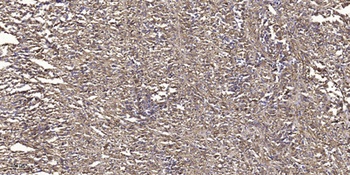 Csk (phospho Ser364) rabbit pAb Antibody