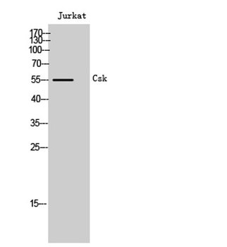 Csk rabbit pAb Antibody