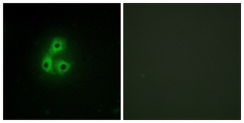 Csk rabbit pAb Antibody