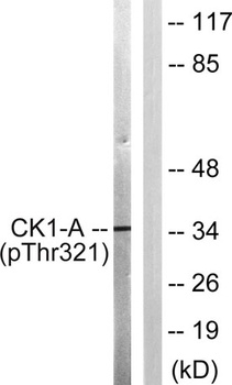 Casein Kinase Iα (phospho Thr321) rabbit pAb Antibody