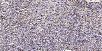 Casein Kinase Iα (phospho Thr321) rabbit pAb Antibody