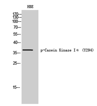 Casein Kinase Iα (phospho Tyr294) rabbit pAb Antibody