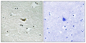 Casein Kinase Iα (phospho Tyr294) rabbit pAb Antibody